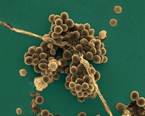 Staphylococcus