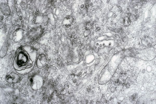 Virus de la rubéole (Rubivirus)