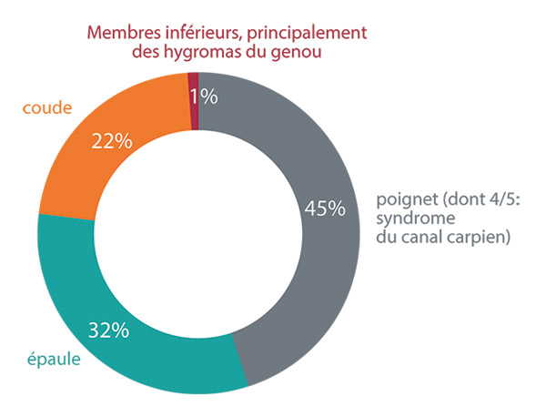 Répartition des maladies professionnelles indemnisées au titre su tableau 57